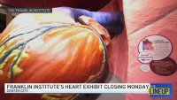 ‘Giant Heart' procedure: The Lineup