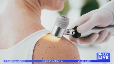 Tips on avoiding skin cancer
