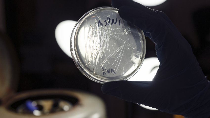 A petri dish with bacteria is held to a light at The Odin biohacking supply company in Oakland, California, U.S., on Wednesday, June 24, 2020. As Covid-19 continues its march around the globe, scientists have embarked on an unprecedented campaign to develop a vaccine against the disease.