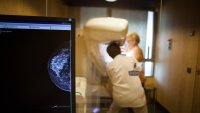 technician carries out a routine mammogram