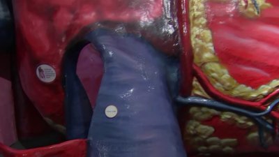 The Franklin Institute's Giant Heart is pumping life into revamped body exhibit