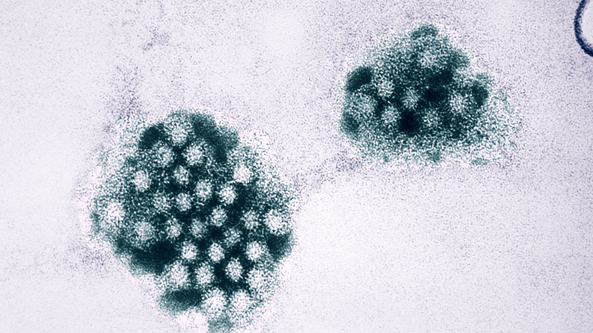 Why Norovirus is So Hard to Kill – NBC10 Philadelphia