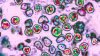 Health officials warn of measles exposure at PHL Airport on July 4th