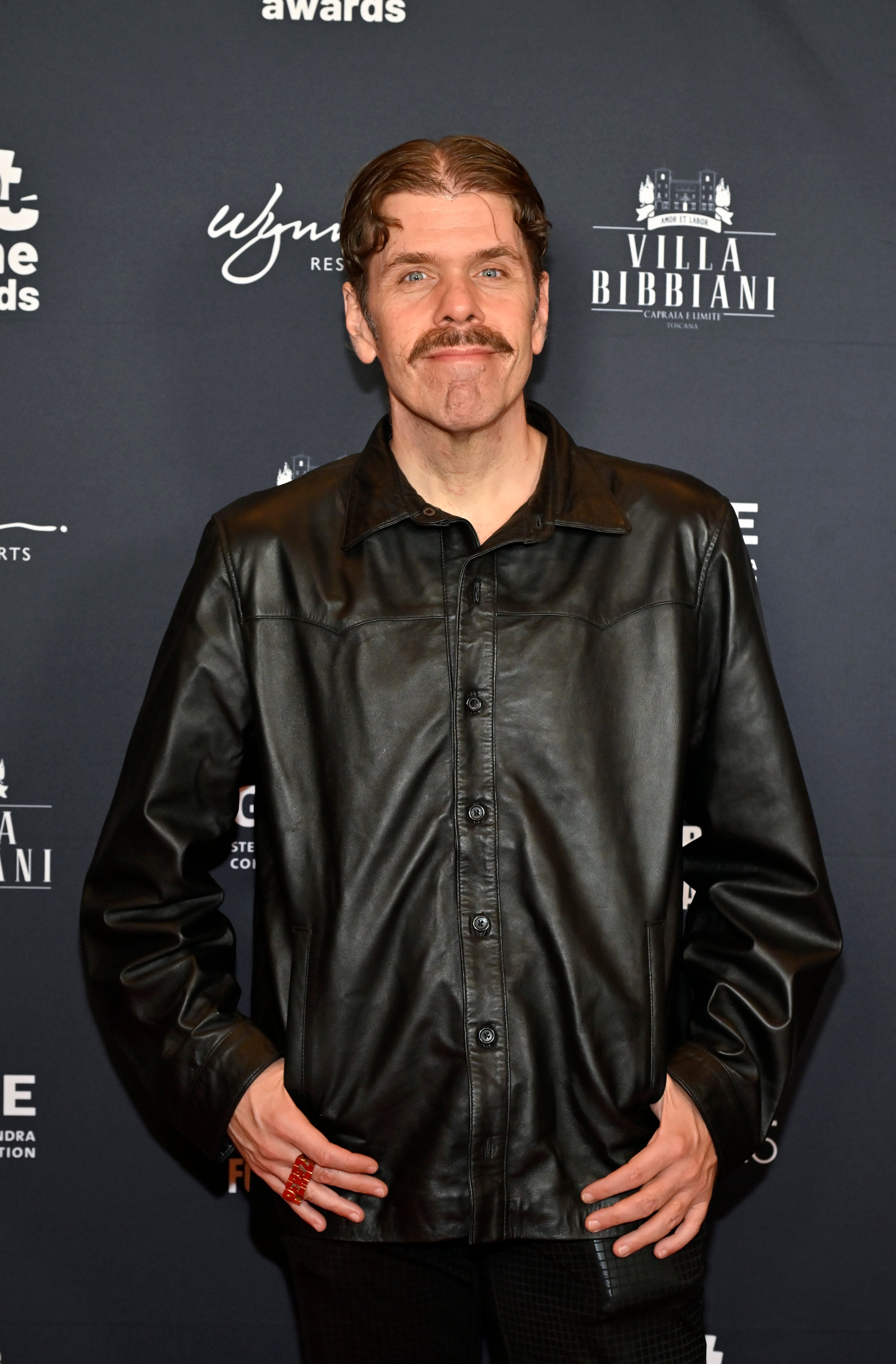 Perez Hilton has long road to recovery, had struggled with depression before self-harm, sister says