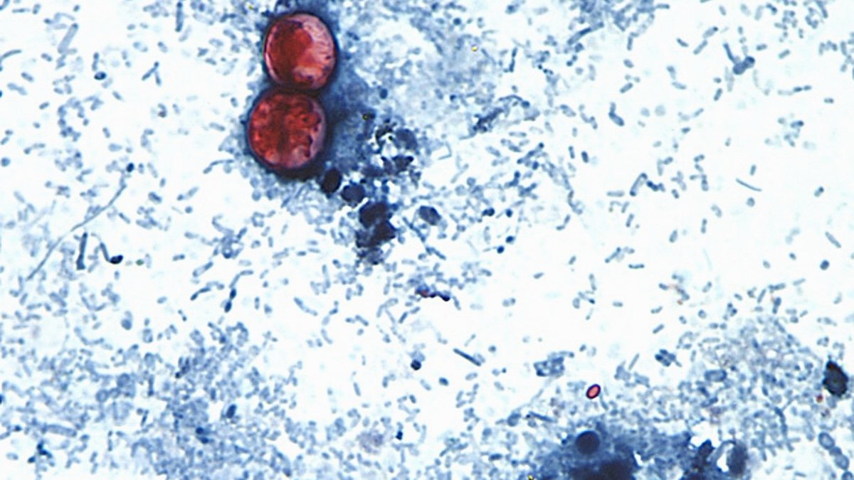Cyclospora outbreak followed years of declining FDA foreign inspections